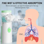 Mesh Nebulizer Machine ( JSL-W303) Model