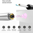 Wireless Visual Earpick – আধুনিক কানের যত্নে